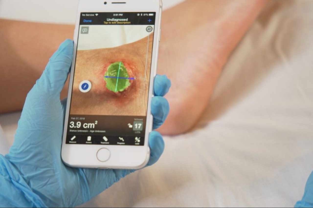 swift-medical-swift-skin-and-wound-app-foot-wound